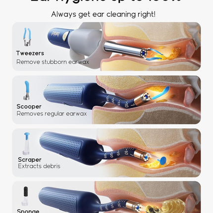 Bebird Ear Wax Removal Tool with Camera & Light – 1080P HD Smart Ear Cleaning Kit with Silicone Tips & WiFi App