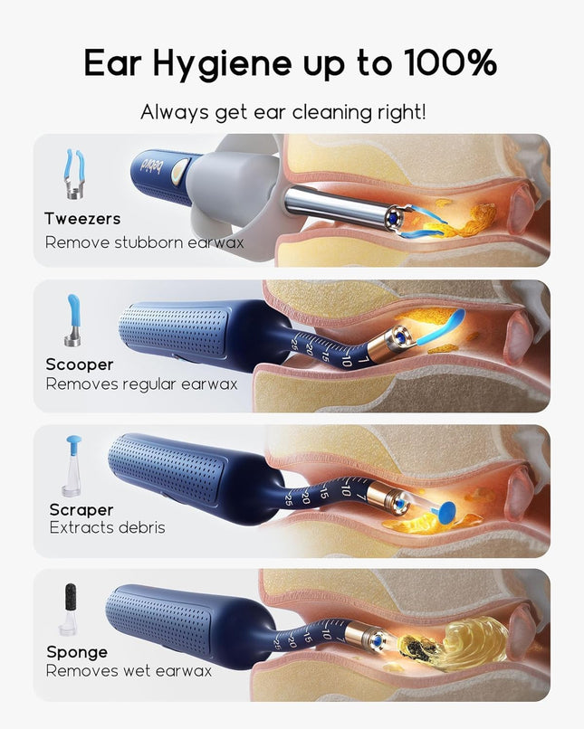 Bebird Ear Wax Removal Tool with Camera & Light – 1080P HD Smart Ear Cleaning Kit with Silicone Tips & WiFi App