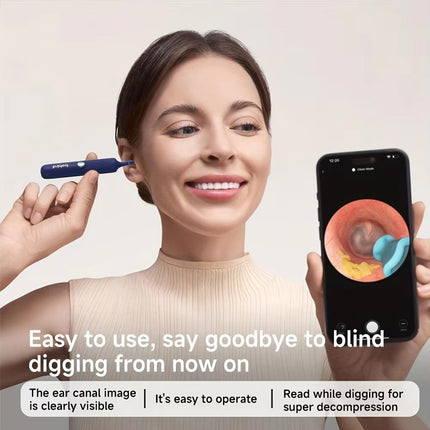 Bebird Ear Wax Removal Tool with Camera & Light – 1080P HD Smart Ear Cleaning Kit with Silicone Tips & WiFi App